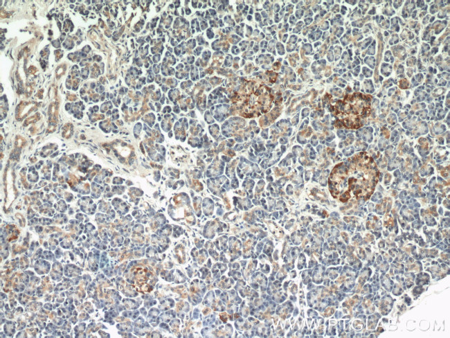 EIF2A Antibody in Immunohistochemistry (Paraffin) (IHC (P))