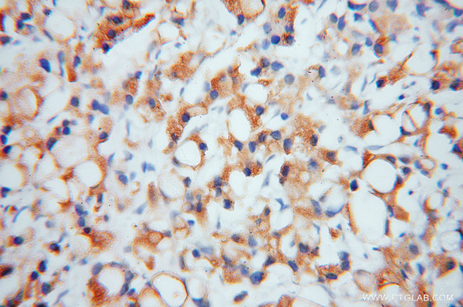 EIF2A Antibody in Immunohistochemistry (Paraffin) (IHC (P))