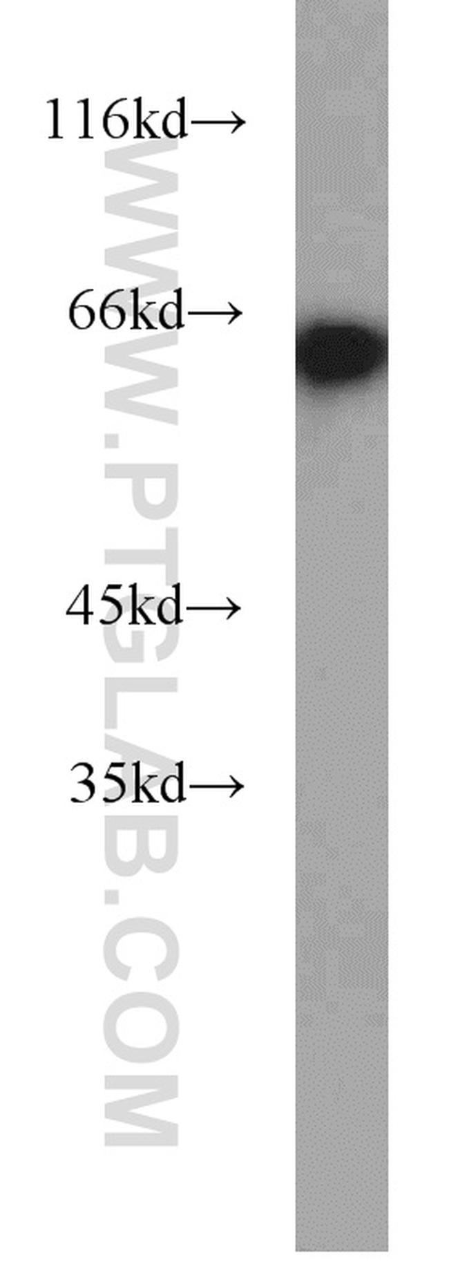 EIF2A Antibody in Western Blot (WB)