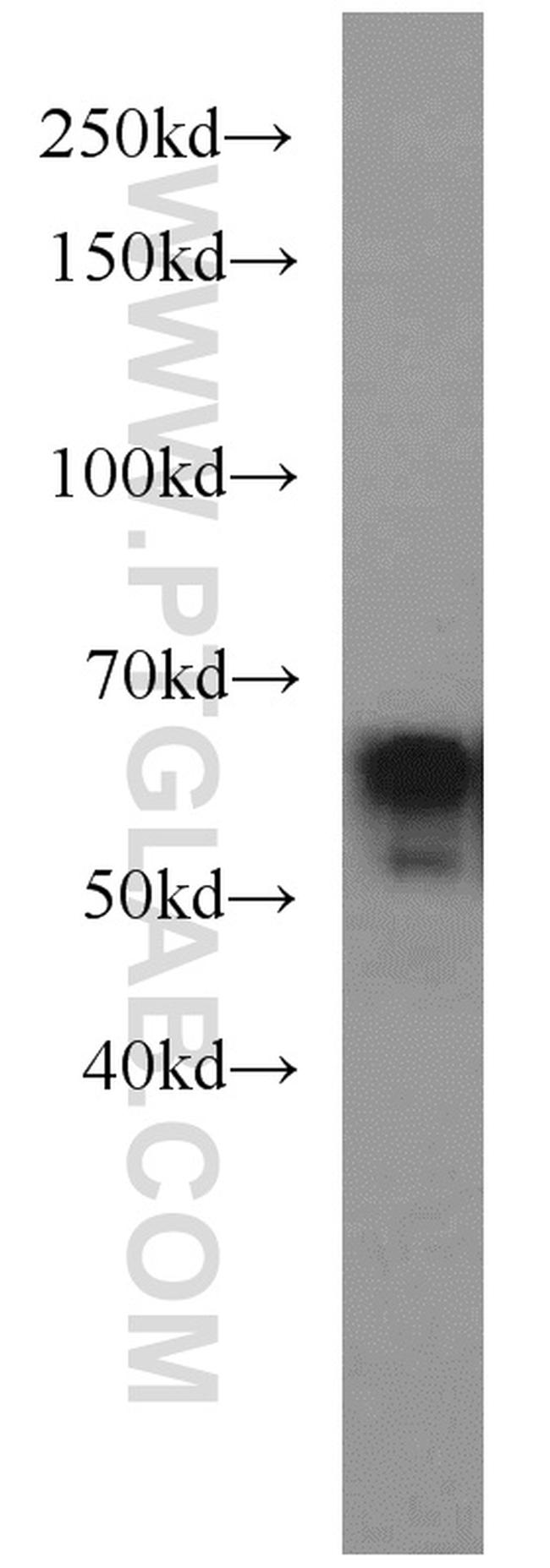 EIF2A Antibody in Western Blot (WB)