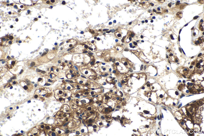 FGF-2 Antibody in Immunohistochemistry (Paraffin) (IHC (P))