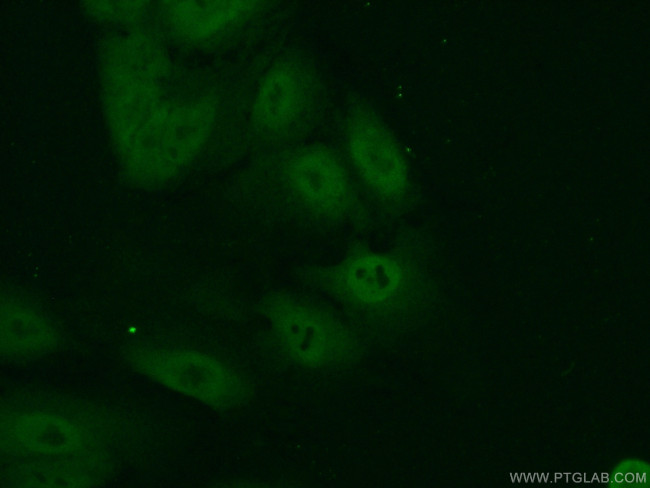 CREB3L1/OASIS Antibody in Immunocytochemistry (ICC/IF)