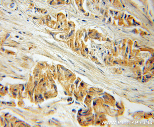 CREB3L1/OASIS Antibody in Immunohistochemistry (Paraffin) (IHC (P))