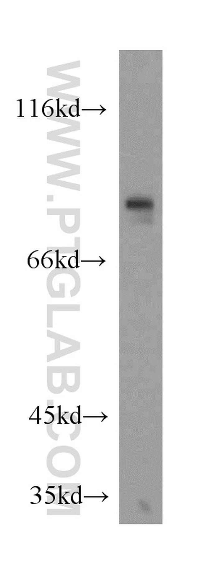 CREB3L1/OASIS Antibody in Western Blot (WB)