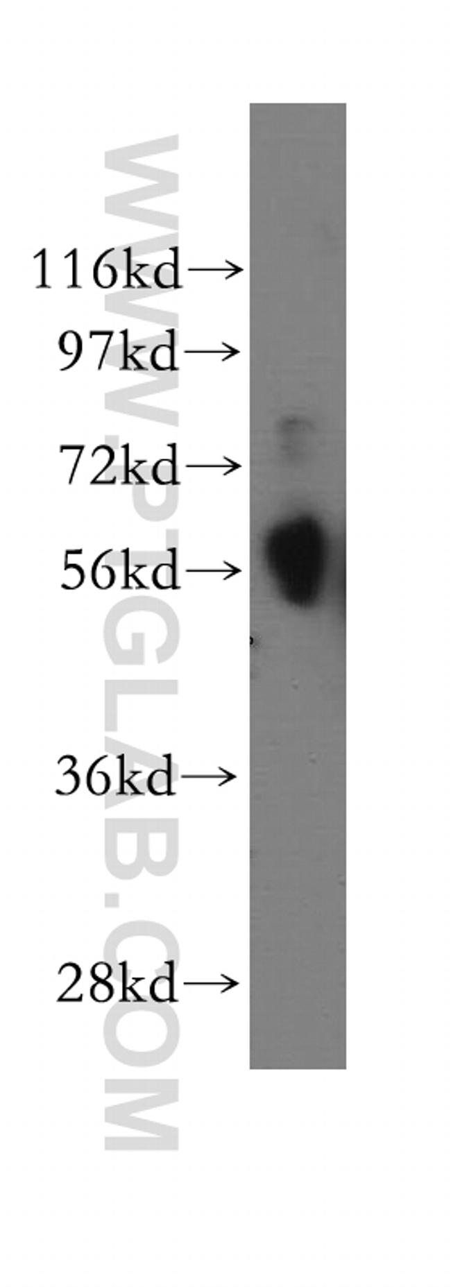 CREB3L1/OASIS Antibody in Western Blot (WB)