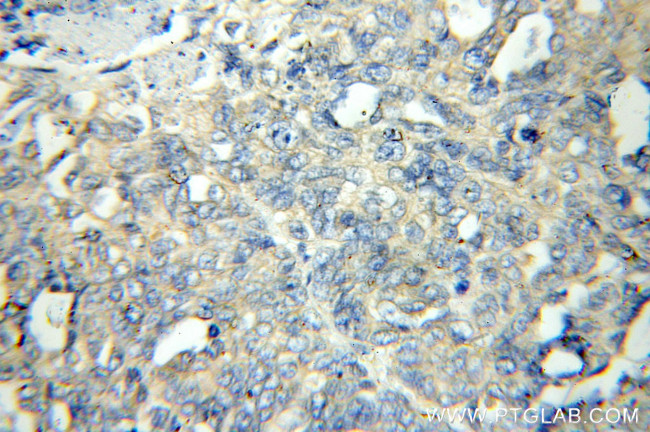 FLCN Antibody in Immunohistochemistry (Paraffin) (IHC (P))