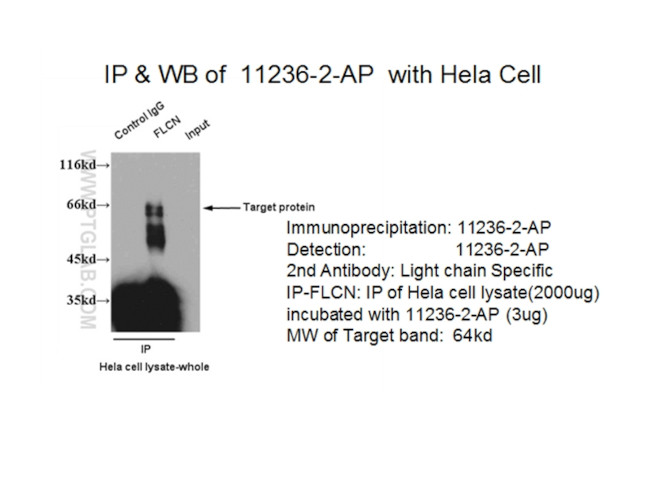 FLCN Antibody in Immunoprecipitation (IP)