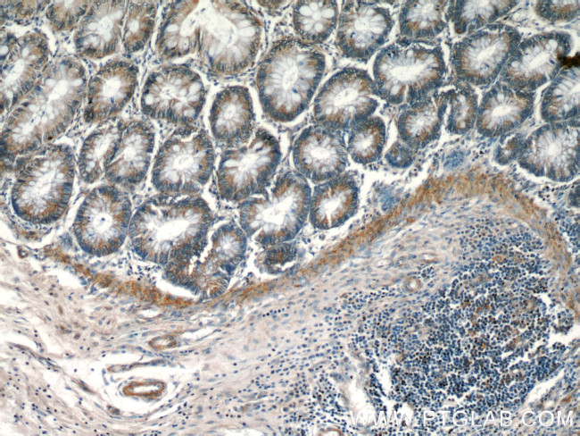 RHOT2 Antibody in Immunohistochemistry (Paraffin) (IHC (P))