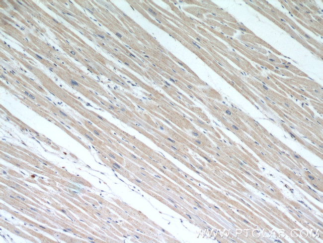 RHOT2 Antibody in Immunohistochemistry (Paraffin) (IHC (P))