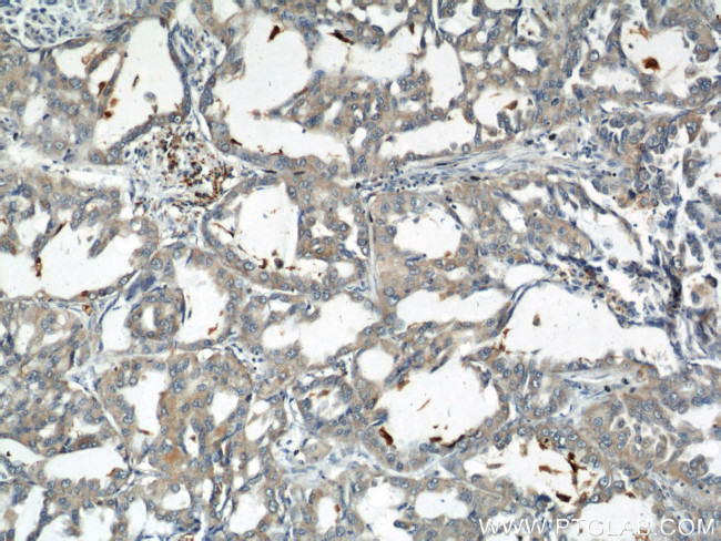 RHOT2 Antibody in Immunohistochemistry (Paraffin) (IHC (P))