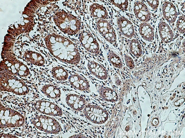 RHOT2 Antibody in Immunohistochemistry (Paraffin) (IHC (P))