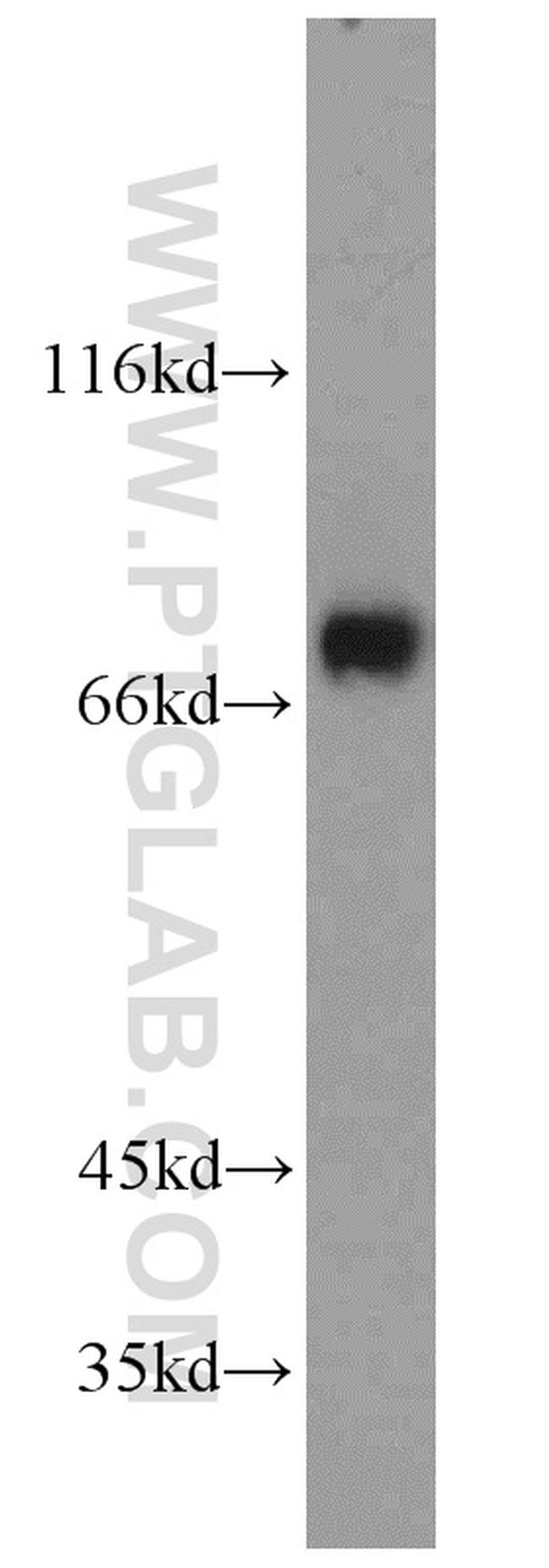 RHOT2 Antibody in Western Blot (WB)