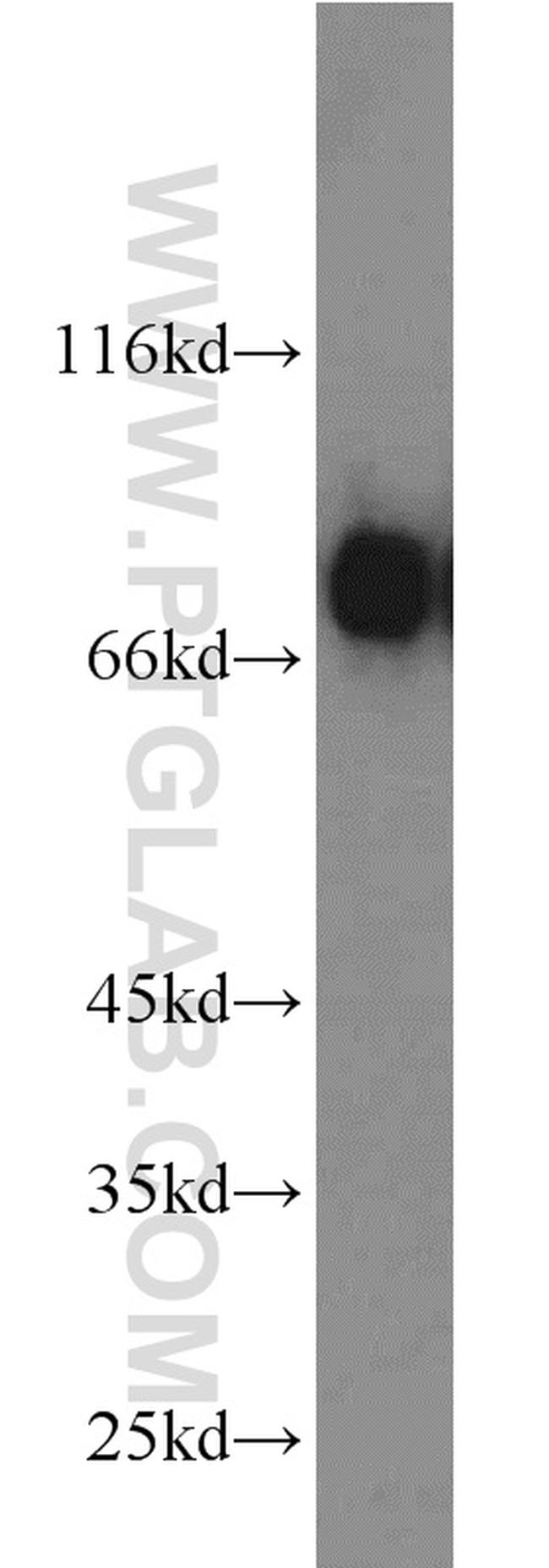 RHOT2 Antibody in Western Blot (WB)