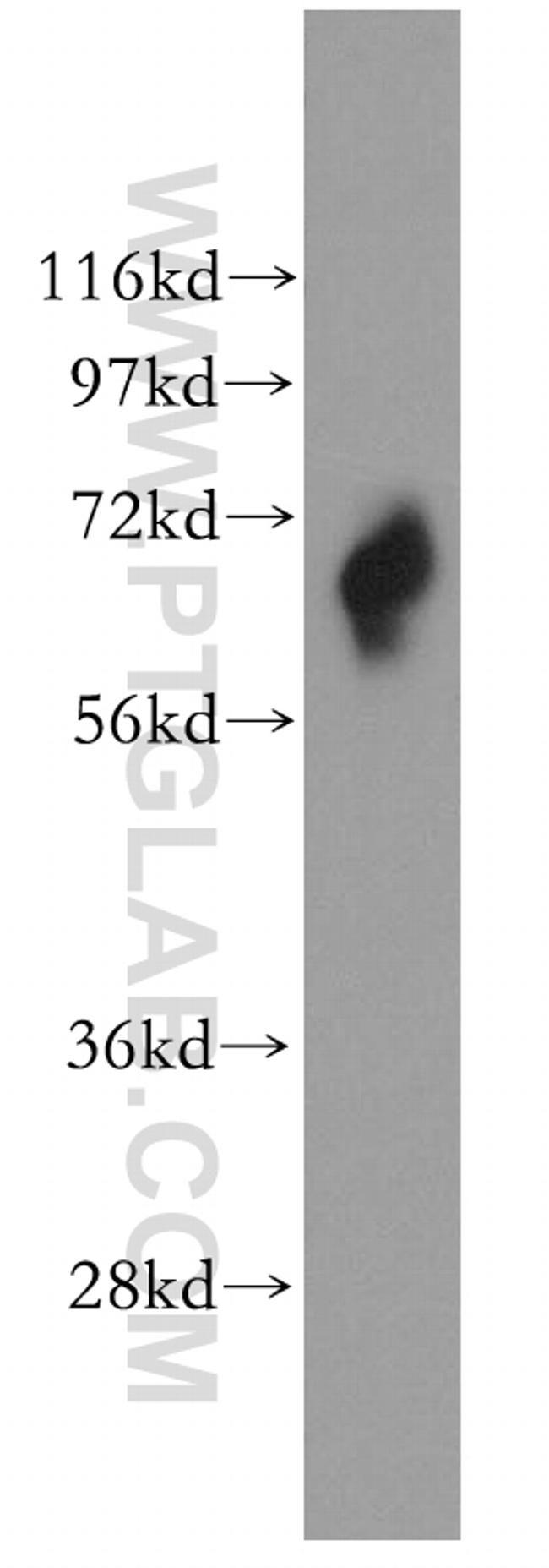 RHOT2 Antibody in Western Blot (WB)