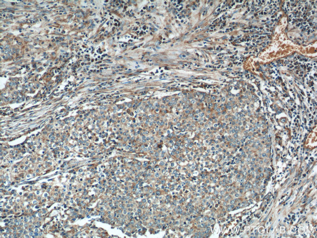 NDUFV1 Antibody in Immunohistochemistry (Paraffin) (IHC (P))