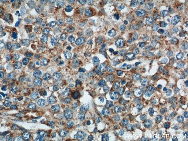 NDUFV1 Antibody in Immunohistochemistry (Paraffin) (IHC (P))