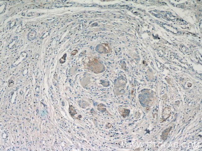 Cathepsin K Antibody in Immunohistochemistry (Paraffin) (IHC (P))