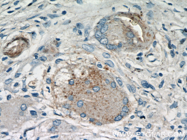 Cathepsin K Antibody in Immunohistochemistry (Paraffin) (IHC (P))