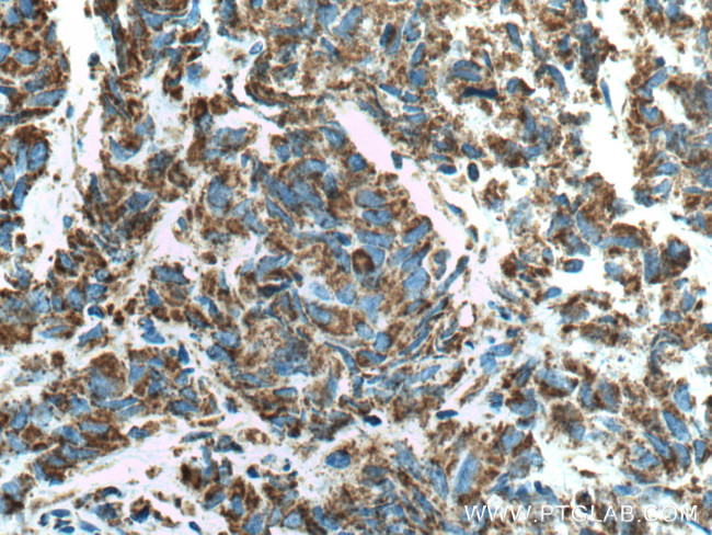 COXIV Antibody in Immunohistochemistry (Paraffin) (IHC (P))