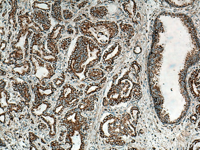 COXIV Antibody in Immunohistochemistry (Paraffin) (IHC (P))