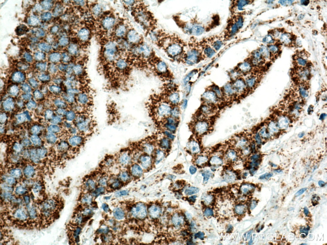 COXIV Antibody in Immunohistochemistry (Paraffin) (IHC (P))