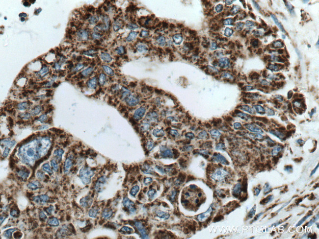 COXIV Antibody in Immunohistochemistry (Paraffin) (IHC (P))