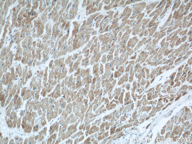 COXIV Antibody in Immunohistochemistry (Paraffin) (IHC (P))