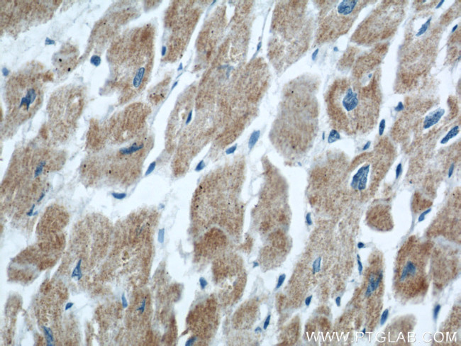 COXIV Antibody in Immunohistochemistry (Paraffin) (IHC (P))