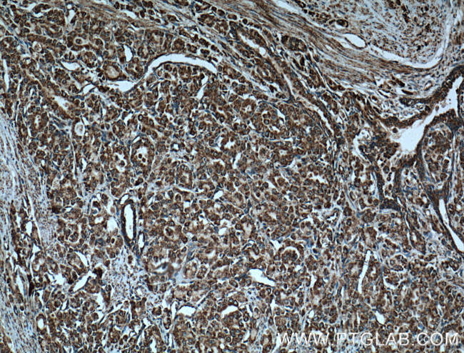 COXIV Antibody in Immunohistochemistry (Paraffin) (IHC (P))