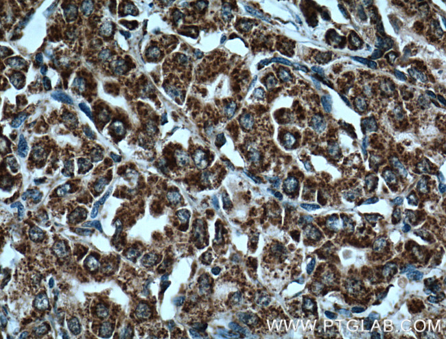 COXIV Antibody in Immunohistochemistry (Paraffin) (IHC (P))