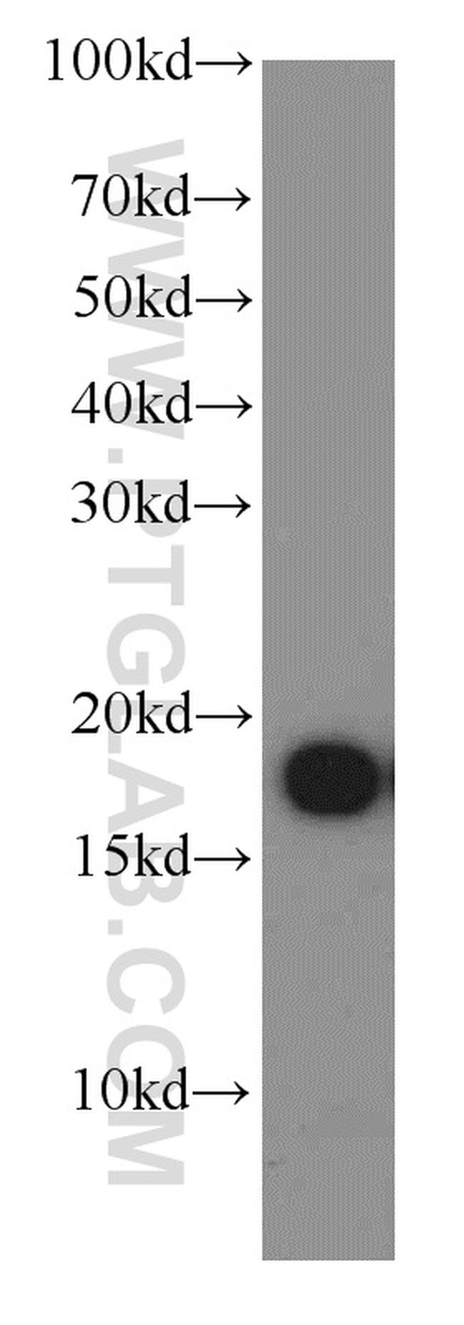 COXIV Antibody in Western Blot (WB)