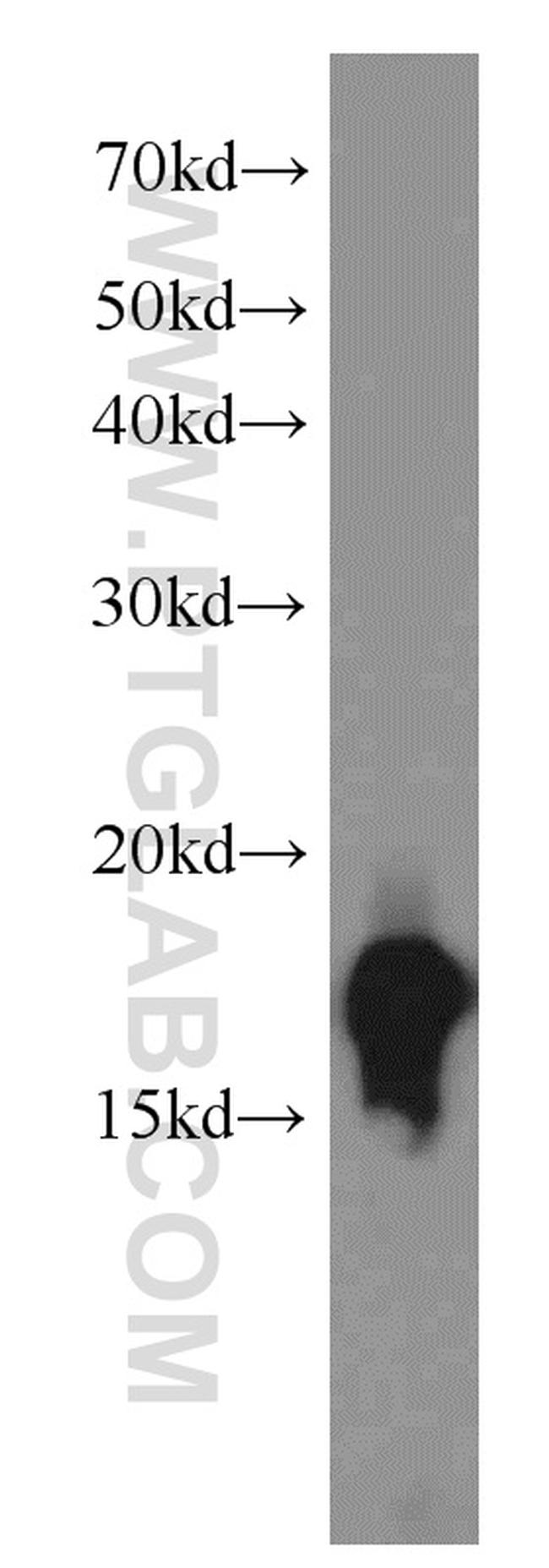 COXIV Antibody in Western Blot (WB)