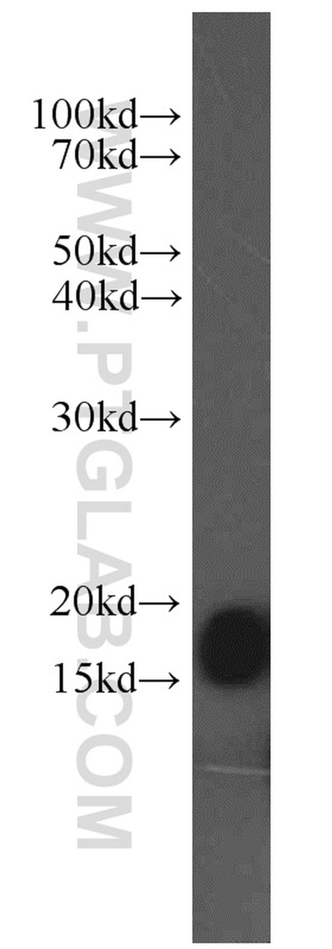 COXIV Antibody in Western Blot (WB)