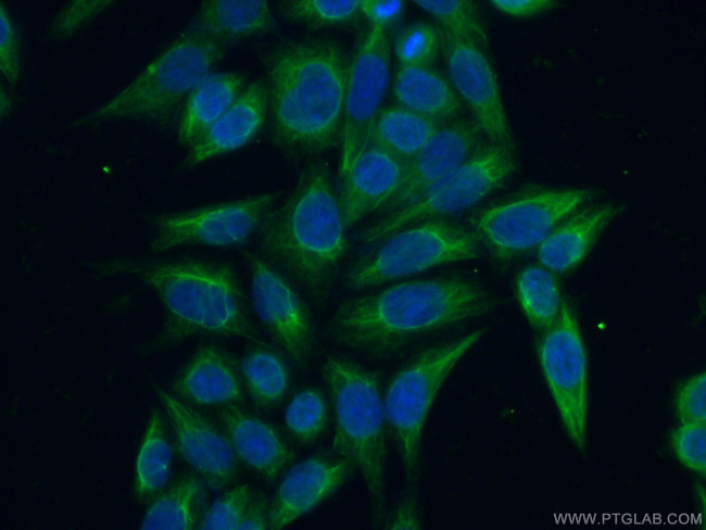 AASDHPPT Antibody in Immunocytochemistry (ICC/IF)