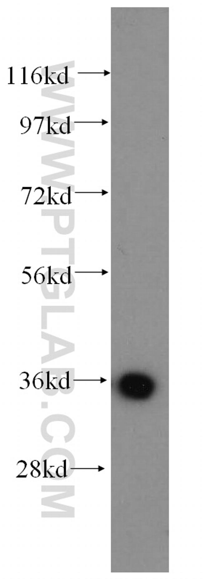 AASDHPPT Antibody in Western Blot (WB)