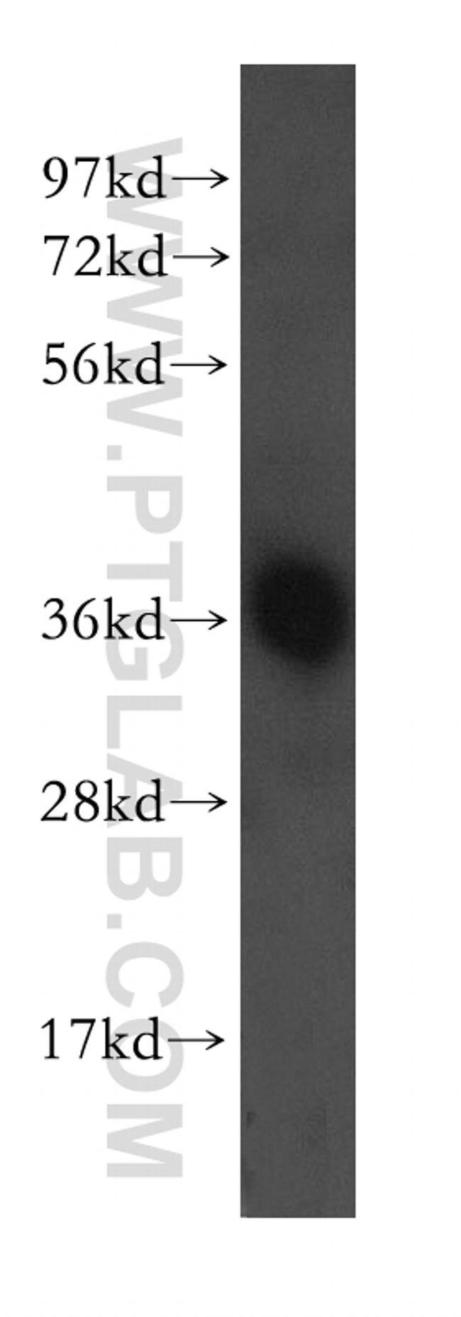 AASDHPPT Antibody in Western Blot (WB)