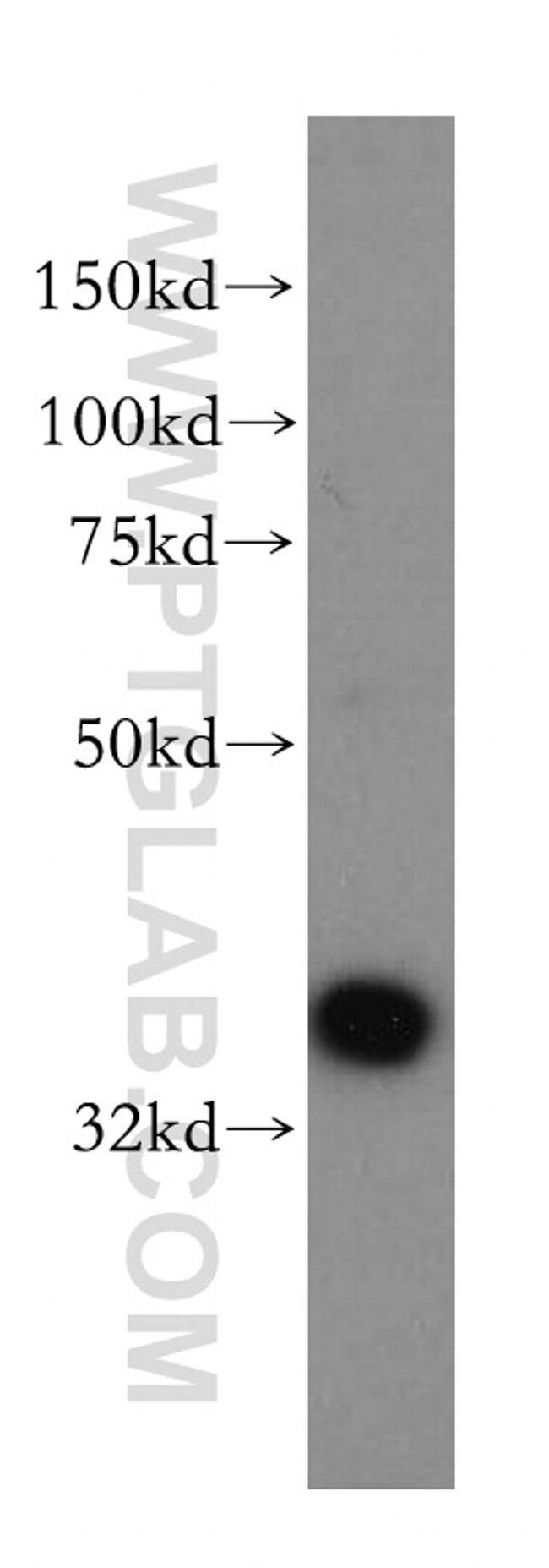 AASDHPPT Antibody in Western Blot (WB)