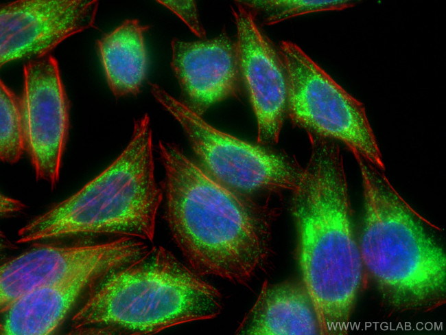 PDI Antibody in Immunocytochemistry (ICC/IF)