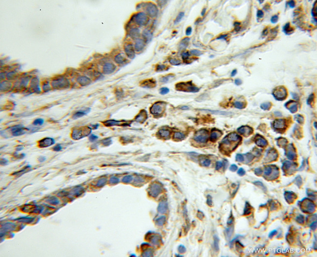 PDI Antibody in Immunohistochemistry (Paraffin) (IHC (P))