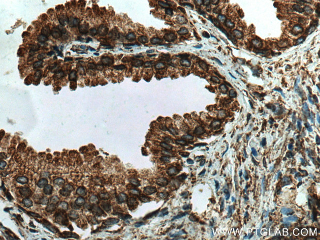 PDI Antibody in Immunohistochemistry (Paraffin) (IHC (P))