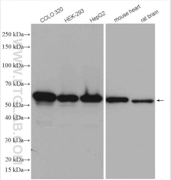 PDI Antibody in Western Blot (WB)