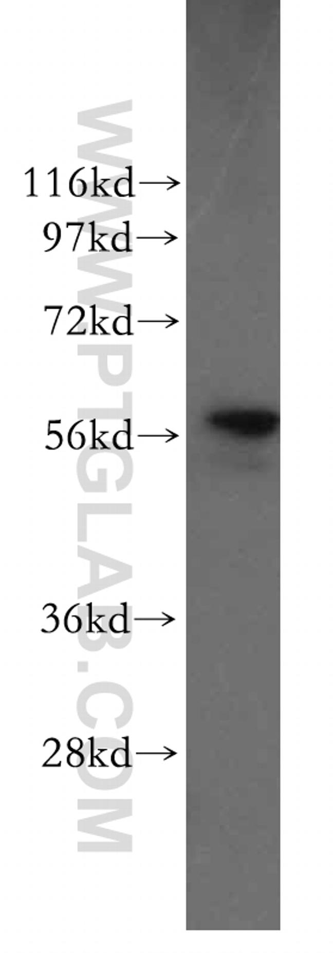 PDI Antibody in Western Blot (WB)