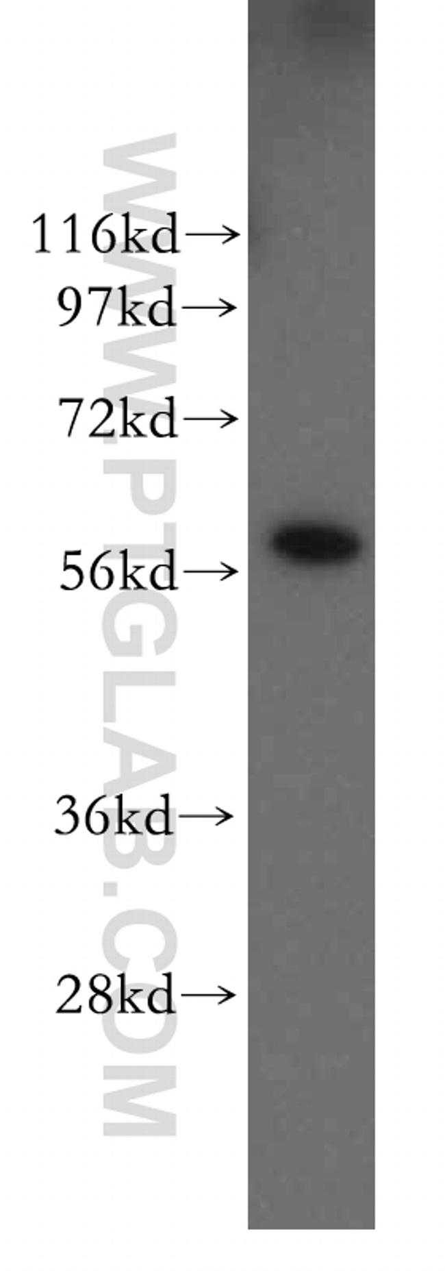 PDI Antibody in Western Blot (WB)