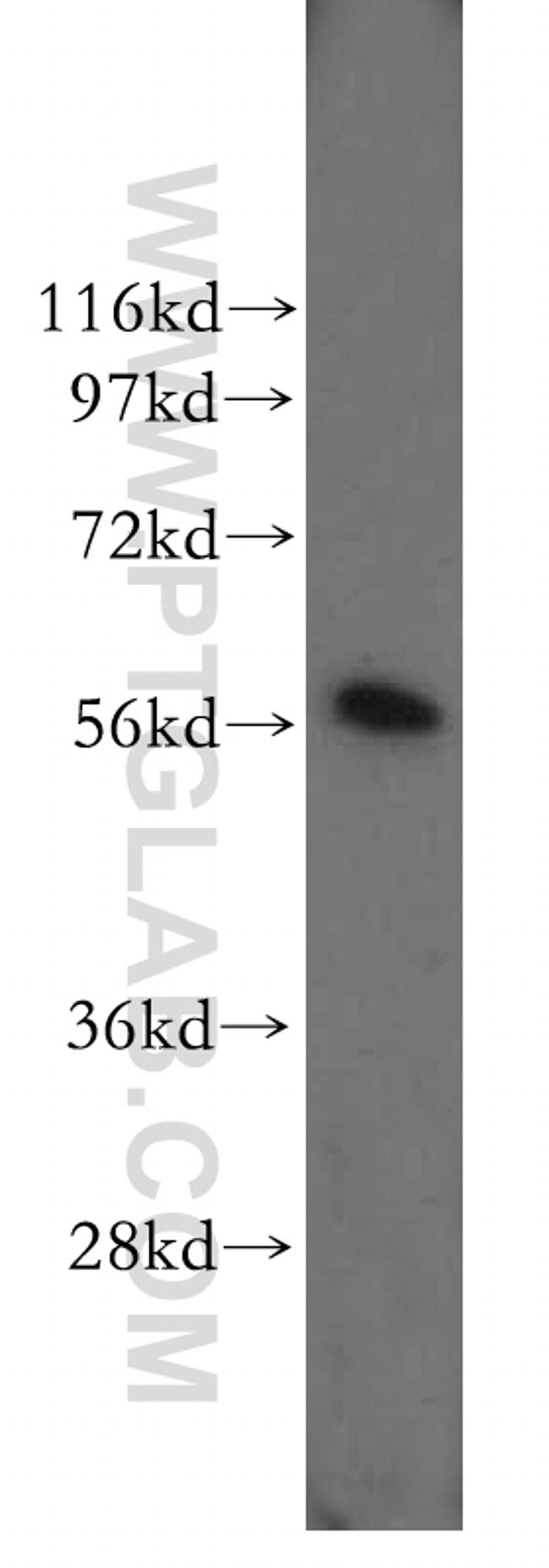 PDI Antibody in Western Blot (WB)