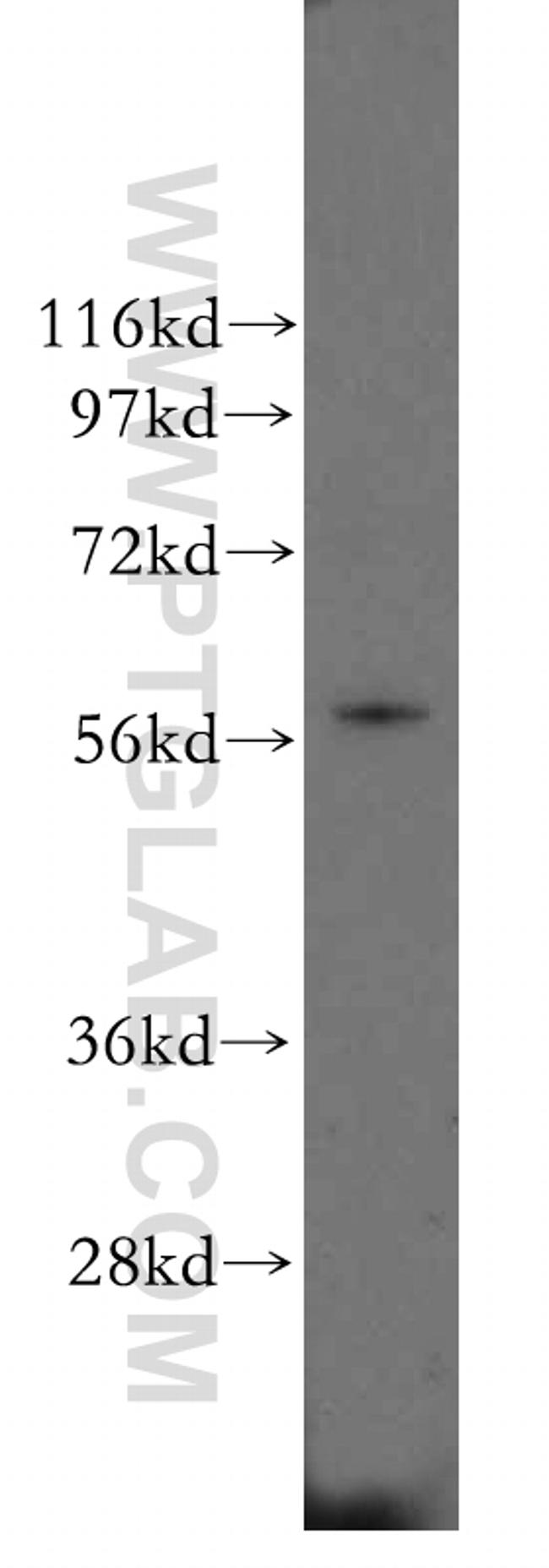 PDI Antibody in Western Blot (WB)