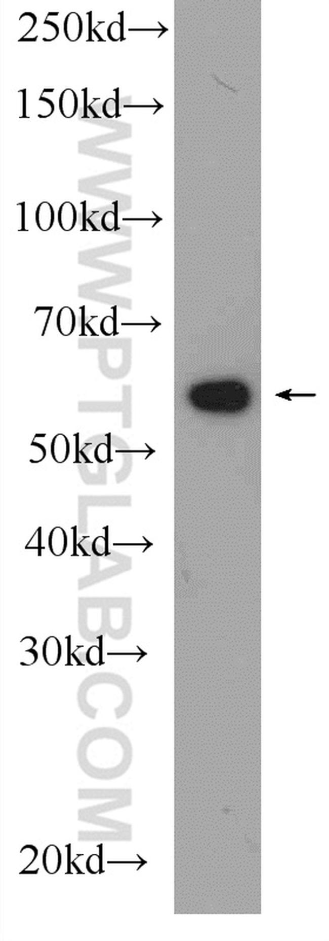 PDI Antibody in Western Blot (WB)