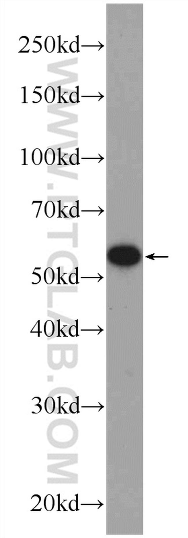 PDI Antibody in Western Blot (WB)