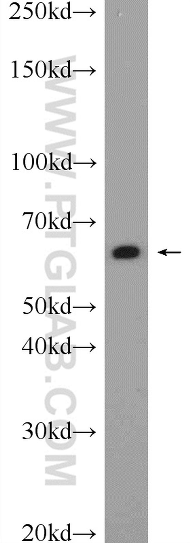 PDI Antibody in Western Blot (WB)