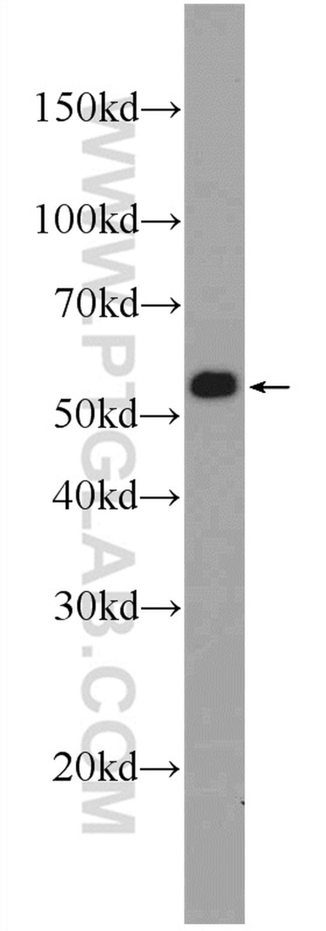 PDI Antibody in Western Blot (WB)