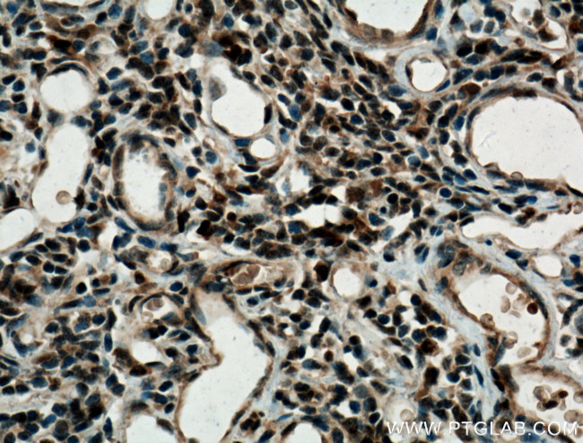 MUM1/IRF4 Antibody in Immunohistochemistry (Paraffin) (IHC (P))